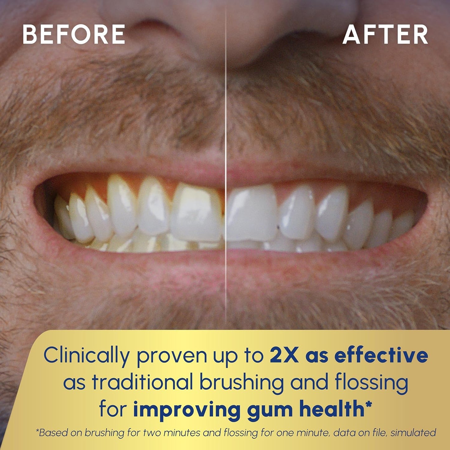 Sonic-Fusion 2.0 Professional Water Flossing Electric Toothbrush